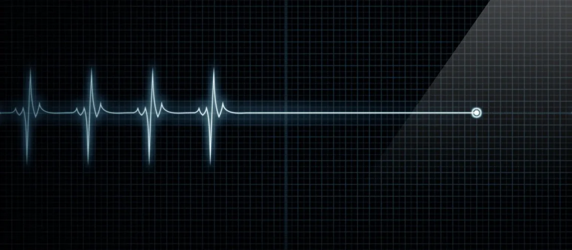 Horizontal Pulse Trace Heart Monitor At Death